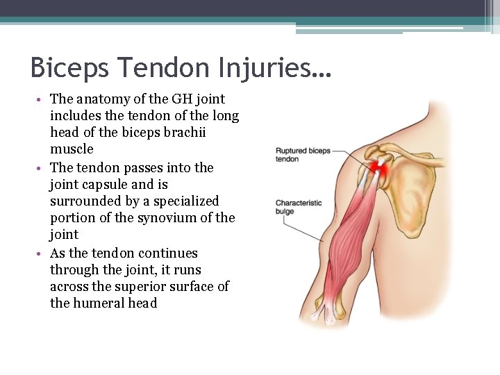 Biceps Tendon Injuries… • The anatomy of the GH joint includes the tendon of