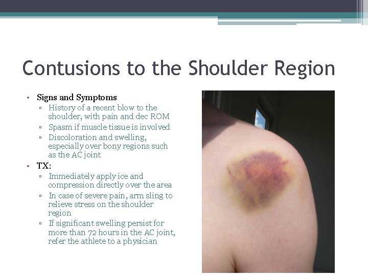 Contusions to the Shoulder Region • Signs and Symptoms ▫ History of a recent