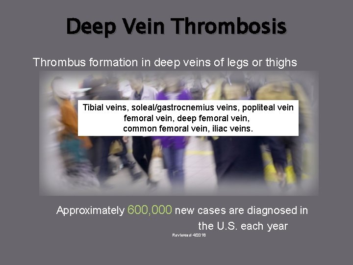 Deep Vein Thrombosis Thrombus formation in deep veins of legs or thighs Tibial veins,
