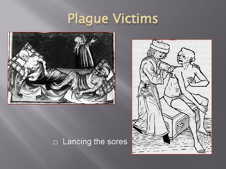 Plague Victims � Lancing the sores 