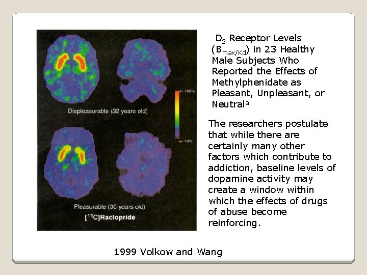  D 2 Receptor Levels (Bmax/Kd) in 23 Healthy Male Subjects Who Reported the