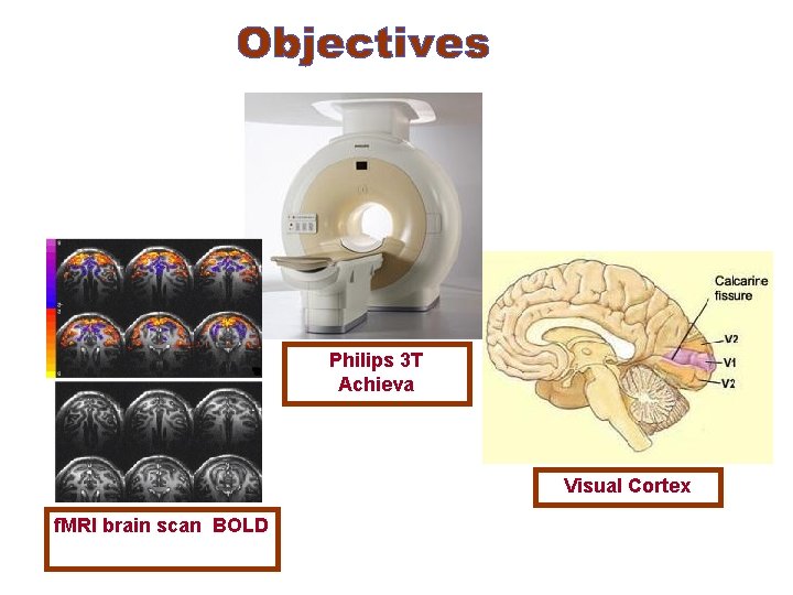 Philips 3 T Achieva Visual Cortex f. MRI brain scan BOLD 