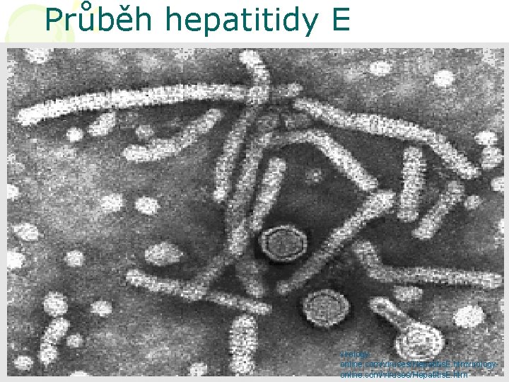 Průběh hepatitidy E virologyonline. com/viruses/Hepatitis. E. htm 