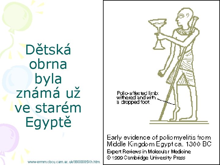 Dětská obrna byla známá už ve starém Egyptě www-ermm. cbcu. cam. ac. uk/9900085 Xh.