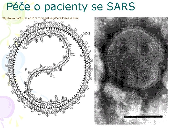 Péče o pacienty se SARS http: //www. bact. wisc. edu/themicrobialworld/Viral. Disease. html 
