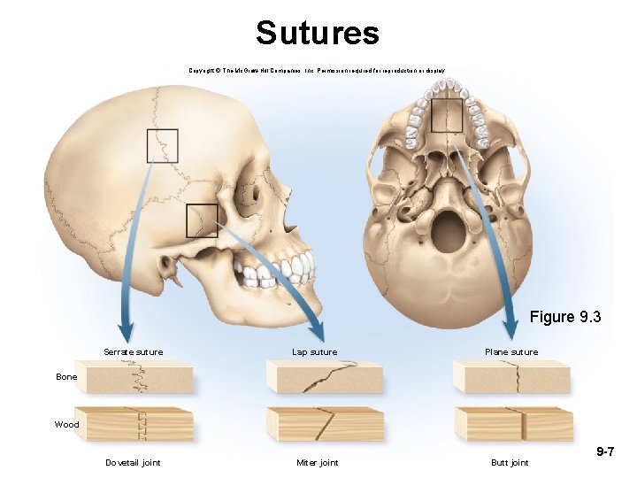 Sutures Copyright © The Mc. Graw-Hill Companies, Inc. Permission required for reproduction or display. Sutures Copyright © The Mc. Graw-Hill Companies, Inc. Permission required for reproduction or display.
