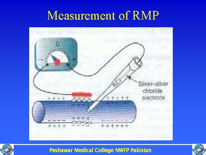 Measurement of RMP Peshawar Medical College NWFP Pakistan 