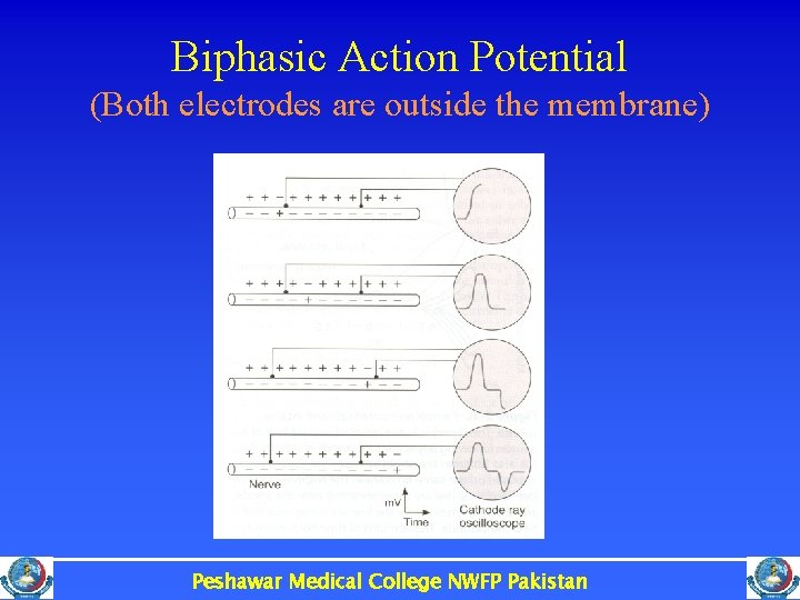 Biphasic Action Potential (Both electrodes are outside the membrane) Peshawar Medical College NWFP Pakistan