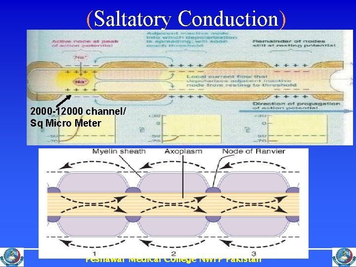 (Saltatory Conduction) 2000 -12000 channel/ Sq Micro Meter Peshawar Medical College NWFP Pakistan 