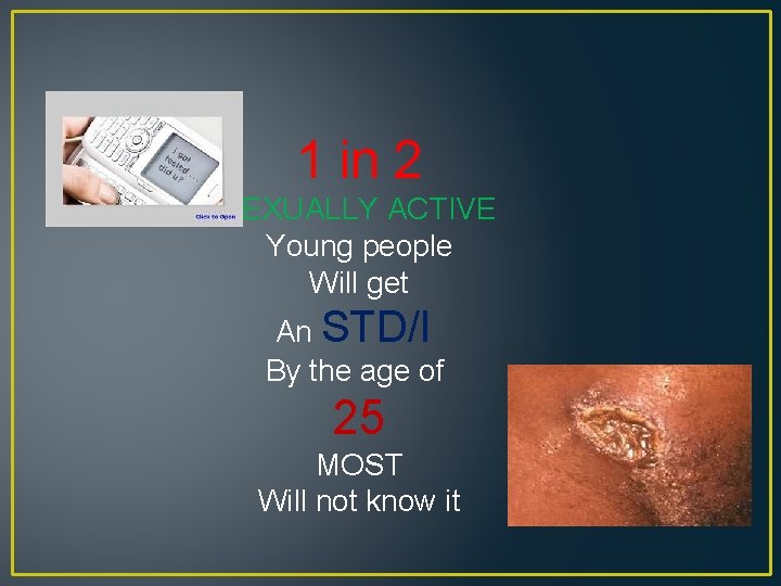 1 in 2 SEXUALLY ACTIVE Young people Will get An STD/I By the age