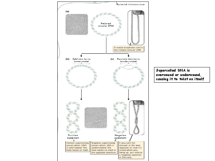 Supercoiled DNA is overwound or underwound, causing it to twist on itself 