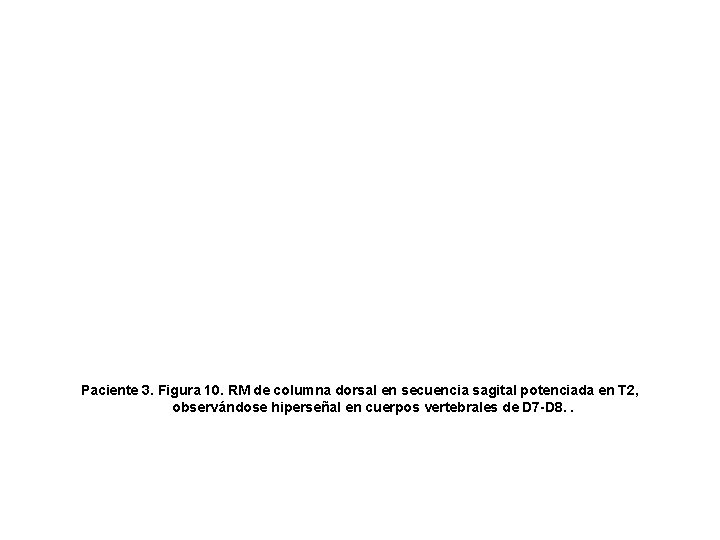 Paciente 3. Figura 10. RM de columna dorsal en secuencia sagital potenciada en T