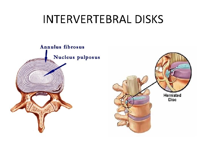 INTERVERTEBRAL DISKS 