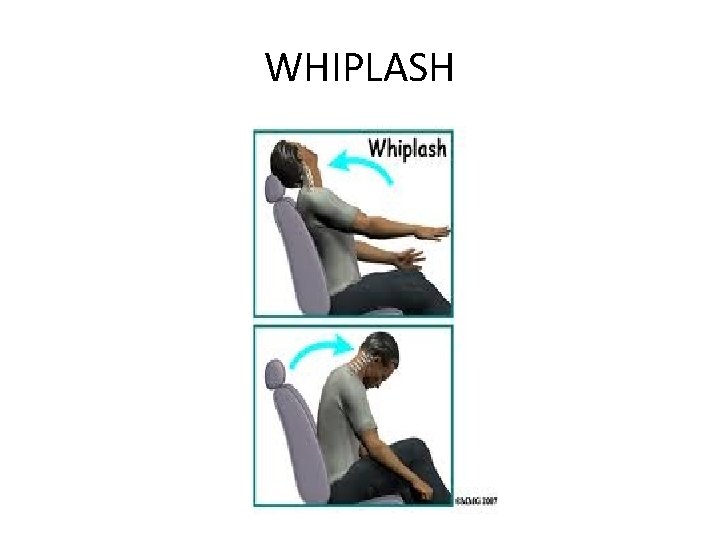 WHIPLASH 