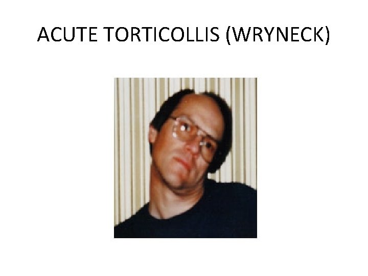 ACUTE TORTICOLLIS (WRYNECK) 