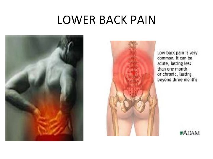 LOWER BACK PAIN 