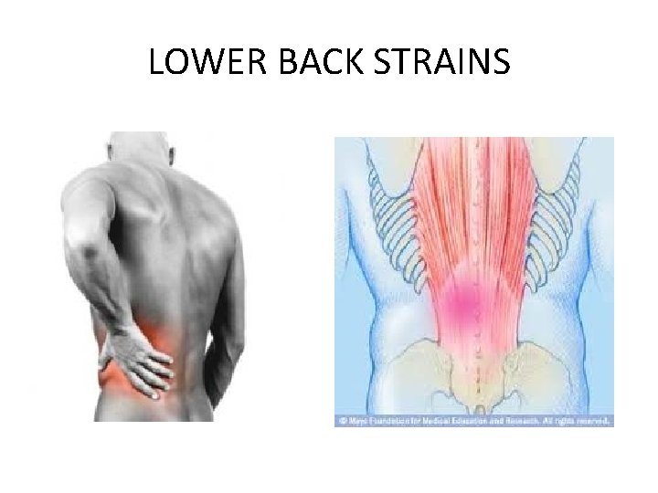 LOWER BACK STRAINS 