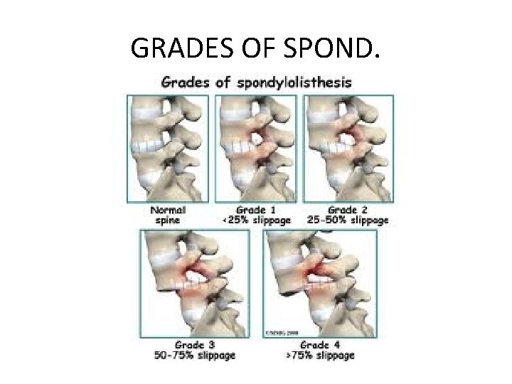 GRADES OF SPOND. 