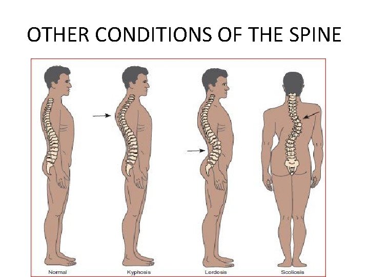 OTHER CONDITIONS OF THE SPINE 