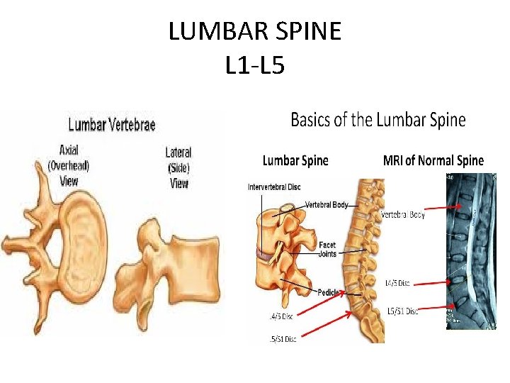 LUMBAR SPINE L 1 -L 5 