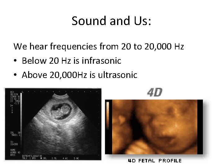 Sound and Us: We hear frequencies from 20 to 20, 000 Hz • Below