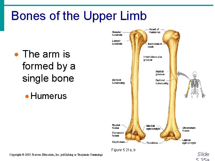 Bones of the Upper Limb · The arm is formed by a single bone