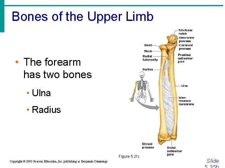 Bones of the Upper Limb • The forearm has two bones • Ulna •