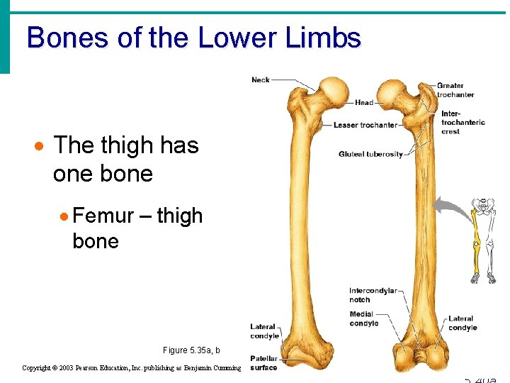 Bones of the Lower Limbs · The thigh has one bone · Femur –