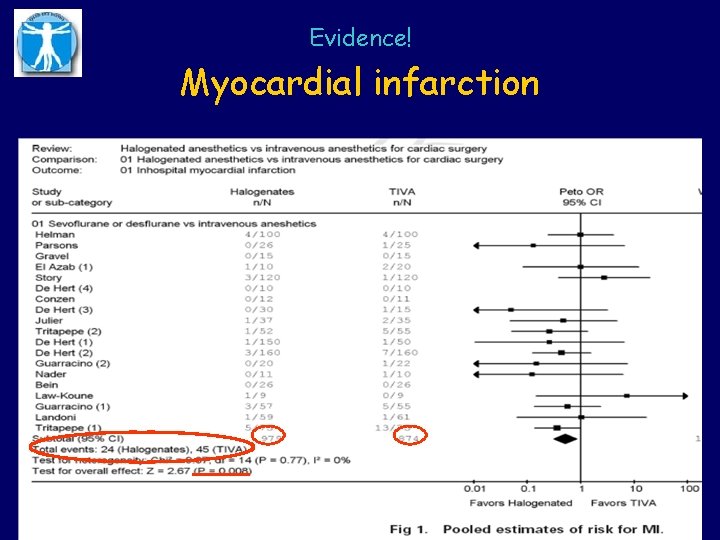 Evidence! Myocardial infarction 