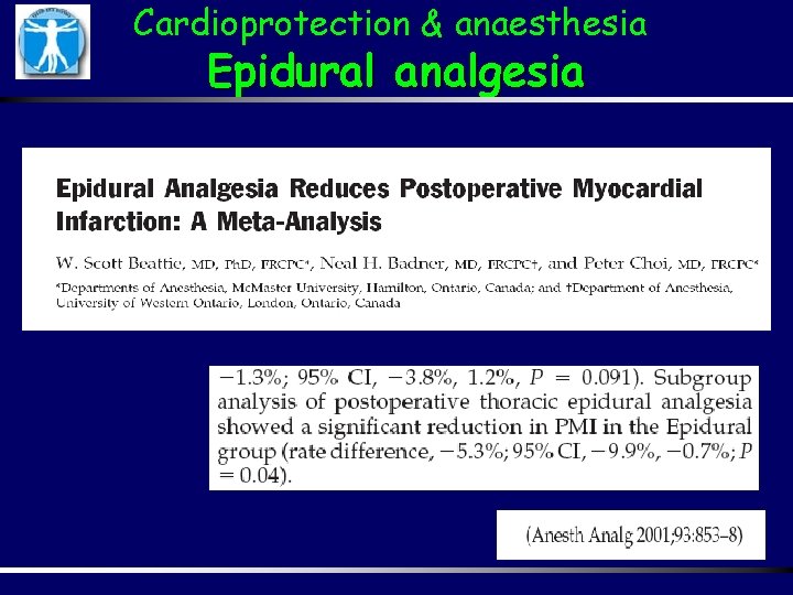 Cardioprotection & anaesthesia Epidural analgesia 