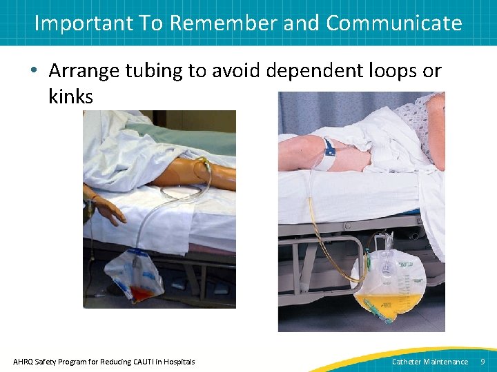 Important To Remember and Communicate • Arrange tubing to avoid dependent loops or kinks