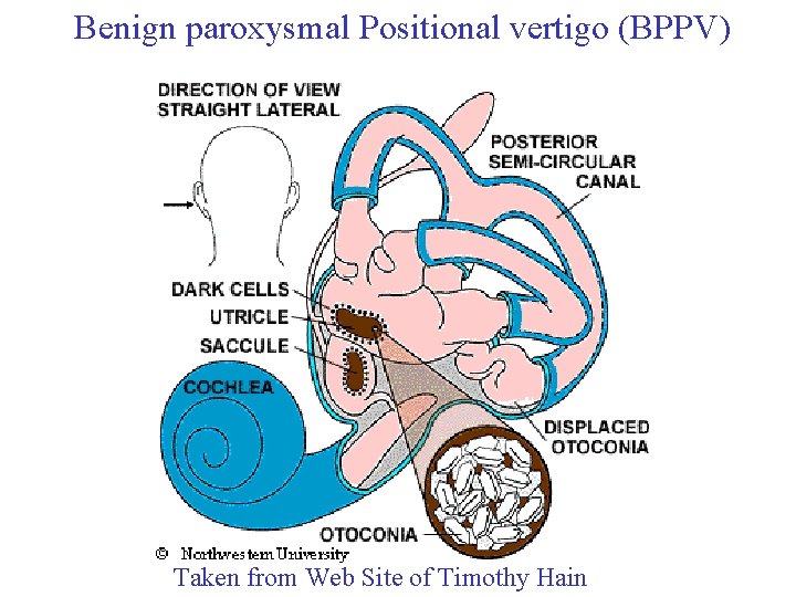 Benign paroxysmal Positional vertigo (BPPV) Taken from Web Site of Timothy Hain 