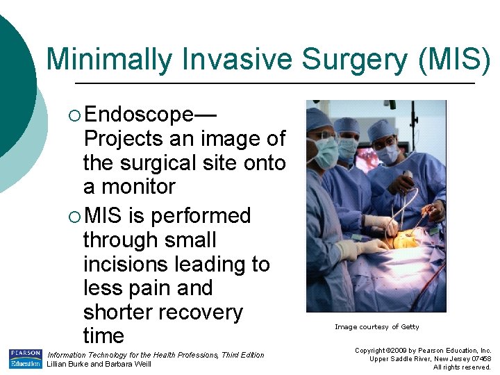 Minimally Invasive Surgery (MIS) ¡ Endoscope— Projects an image of the surgical site onto