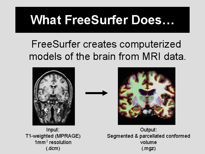 What Free. Surfer Does… Free. Surfer creates computerized models of the brain from MRI