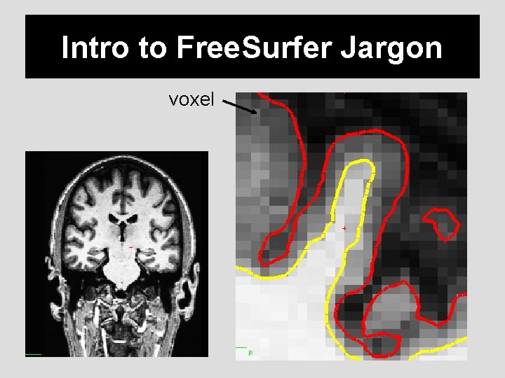 Intro to Free. Surfer Jargon voxel 