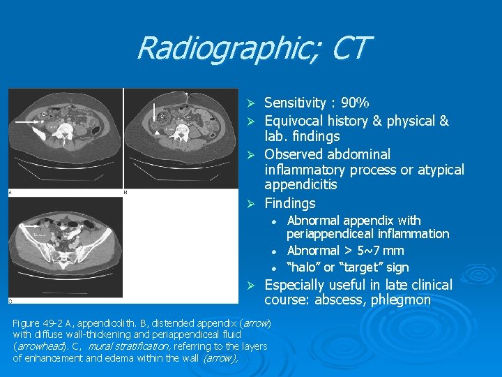 Radiographic; CT Ø Ø Sensitivity : 90% Equivocal history & physical & lab. findings Radiographic; CT Ø Ø Sensitivity : 90% Equivocal history & physical & lab. findings