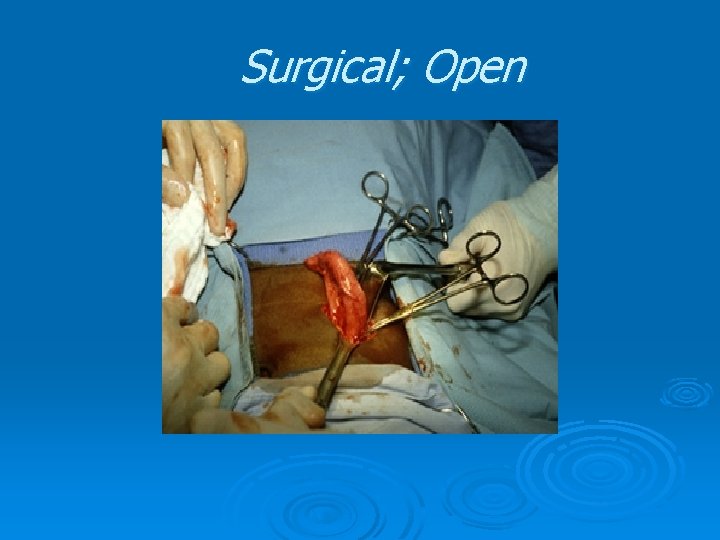 Surgical; Open Surgical; Open