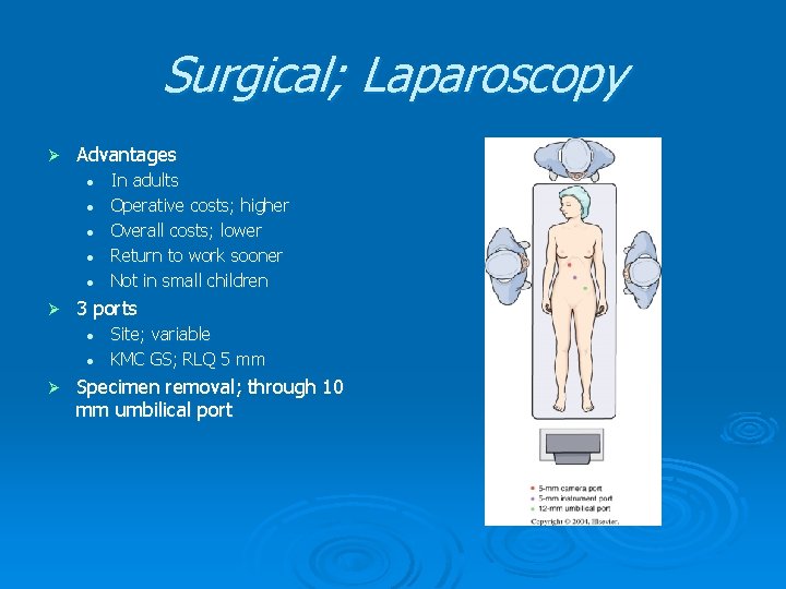 Surgical; Laparoscopy Ø Advantages l l l Ø 3 ports l l Ø In Surgical; Laparoscopy Ø Advantages l l l Ø 3 ports l l Ø In
