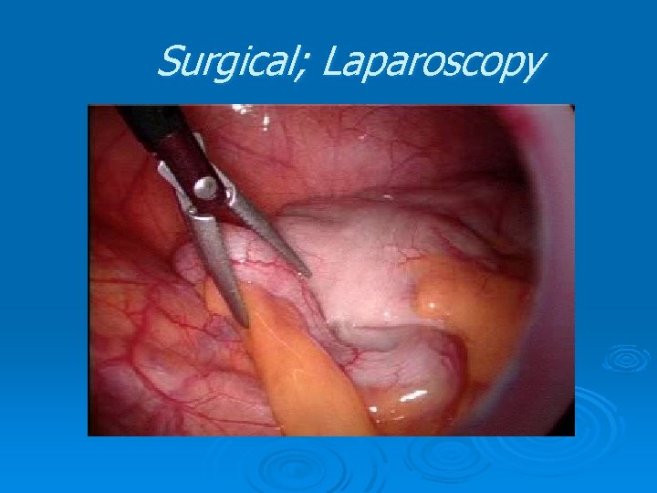 Surgical; Laparoscopy Surgical; Laparoscopy