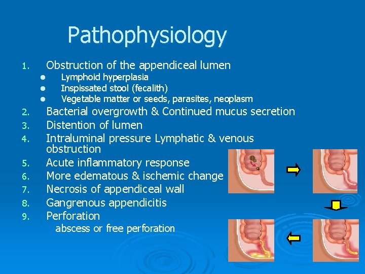 Pathophysiology Obstruction of the appendiceal lumen 1. l l l 2. 3. 4. 5. Pathophysiology Obstruction of the appendiceal lumen 1. l l l 2. 3. 4. 5.