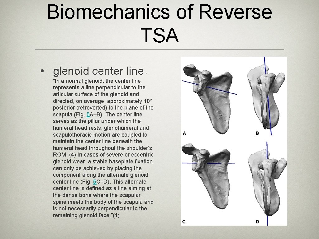 Biomechanics of Reverse TSA • glenoid center line - “In a normal glenoid, the