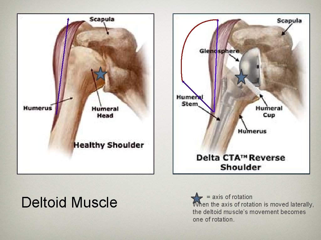 Deltoid Muscle = axis of rotation When the axis of rotation is moved laterally,