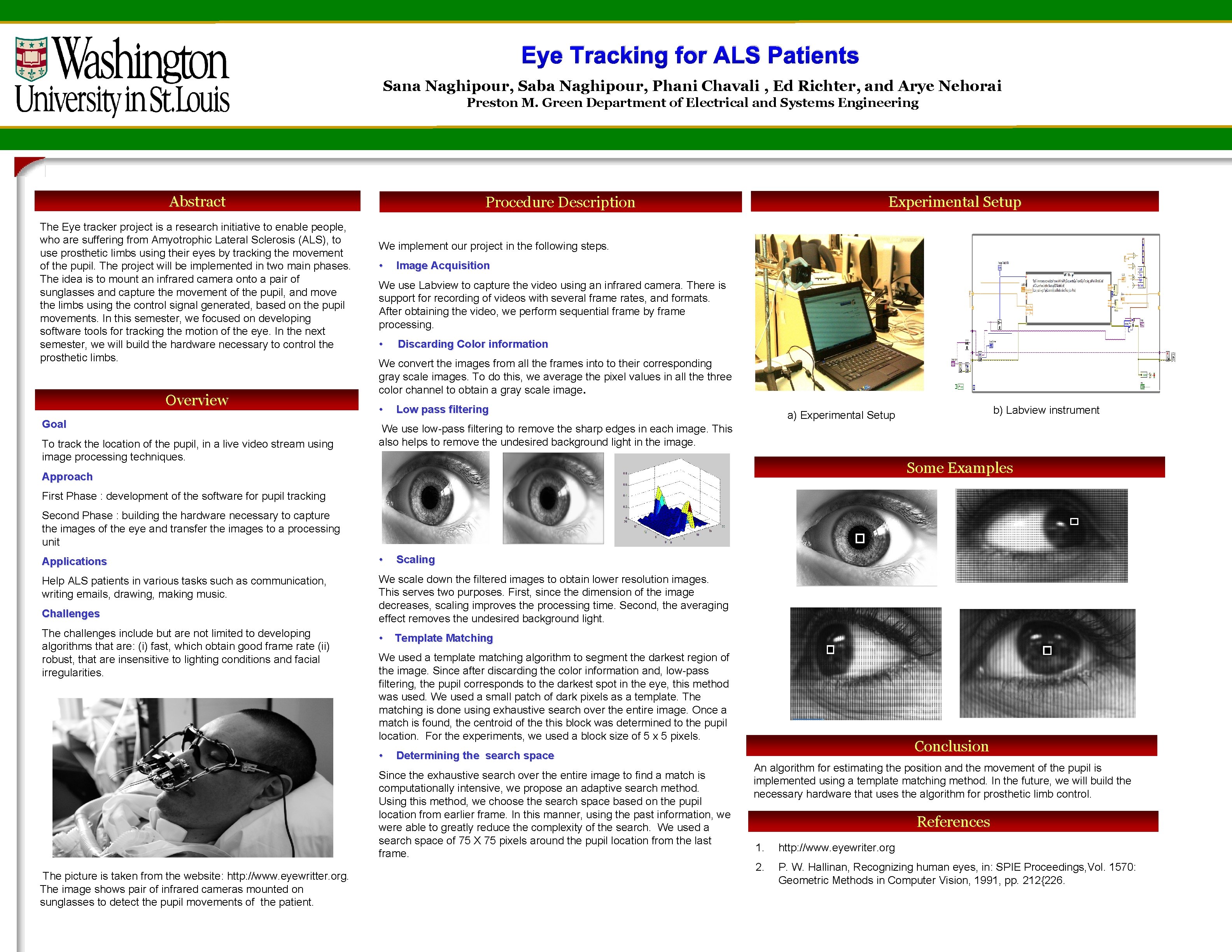 Eye Tracking for ALS Patients Sana Naghipour, Saba Naghipour, Phani Chavali , Ed Richter,