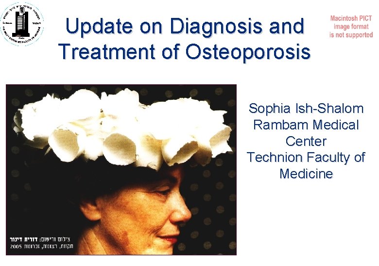 Update on Diagnosis and Treatment of Osteoporosis Sophia Ish-Shalom Rambam Medical Center Technion Faculty