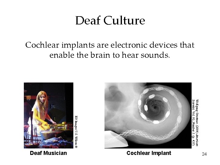 Deaf Culture Cochlear implants are electronic devices that enable the brain to hear sounds.