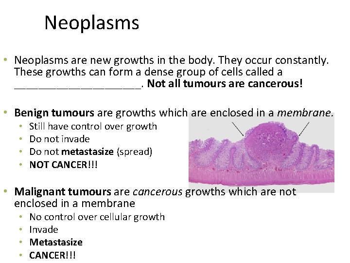 Neoplasms • Neoplasms are new growths in the body. They occur constantly. These growths