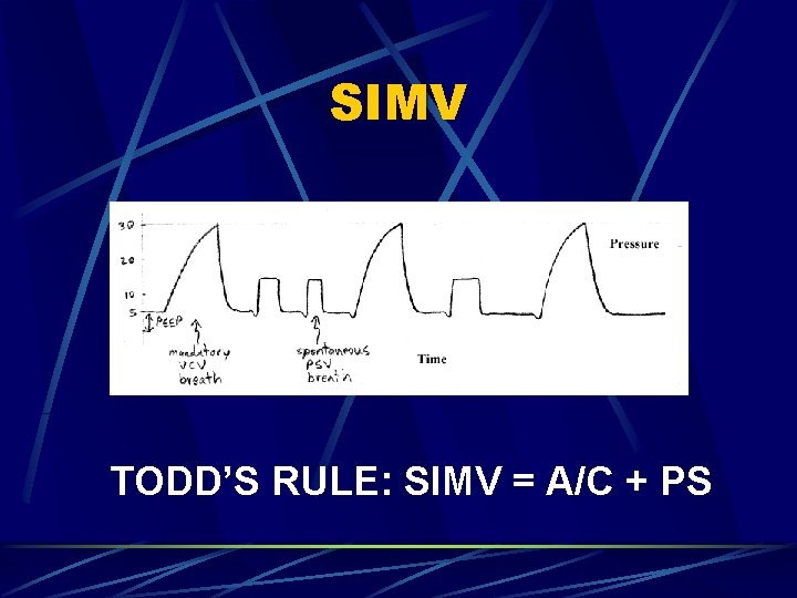 SIMV TODD’S RULE: SIMV = A/C + PS 