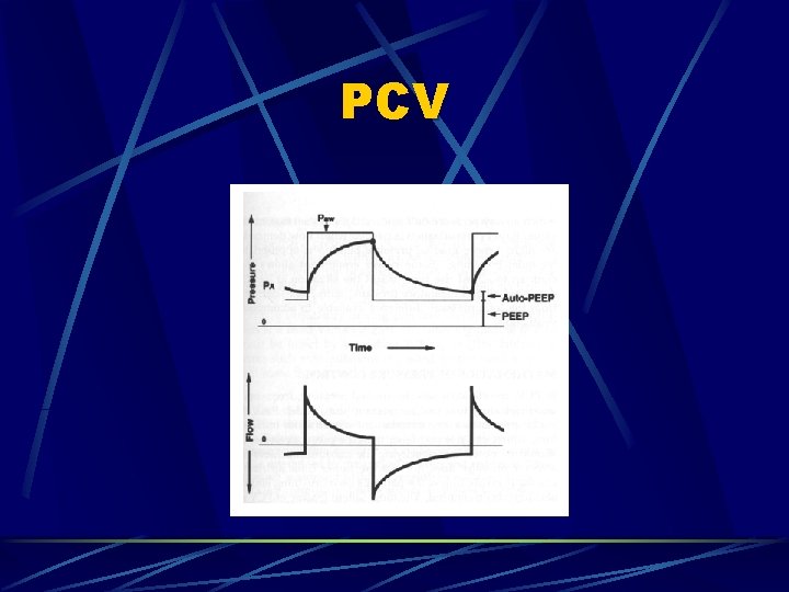 PCV 