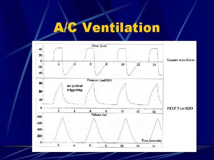 A/C Ventilation 