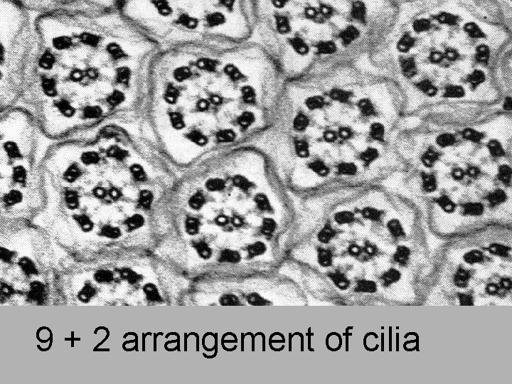 9 + 2 arrangement of cilia 